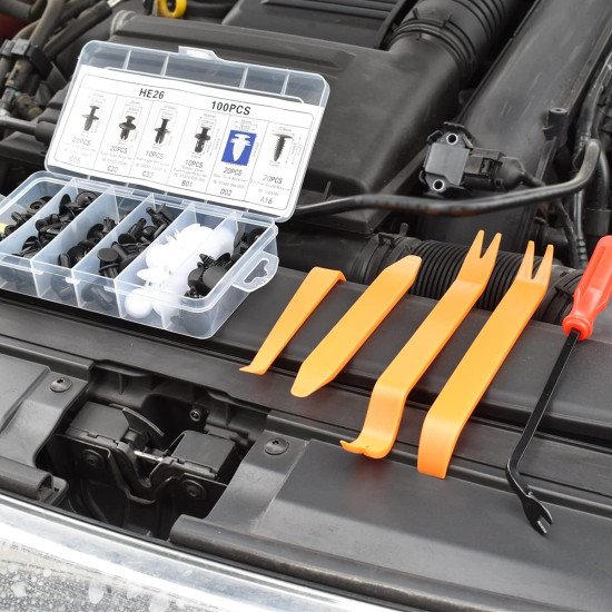 Fix Loose Bumpers & Panels Fast – 105PCS Car Retainer Clip Kit with Removal Tool