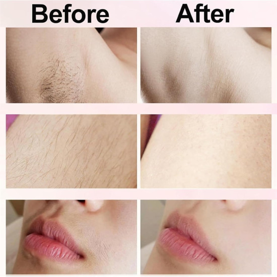 2-in-1 Women's Body Shaver