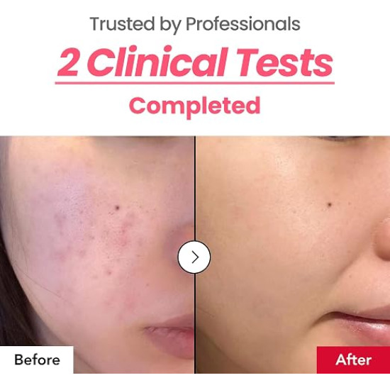 Dark Spot & Hyperpigmentation Cream – 6% Tranexamic Acid & 5% Niacinamide Pink Glow Cream 