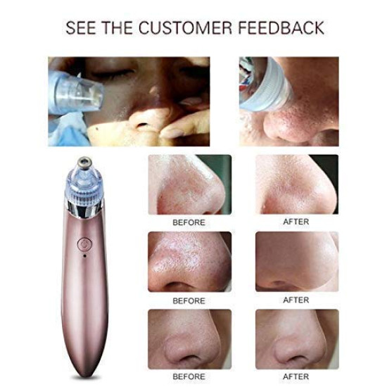 Electric Vacuum Pore Cleaner Electric Vacuum Pore Cleaner