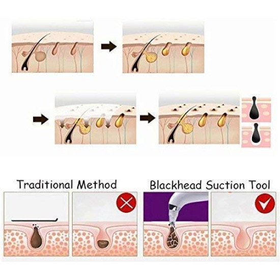 Electric Vacuum Pore Cleaner Electric Vacuum Pore Cleaner