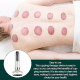 Cellulite Massager Intelligent Cupping Therapy Set