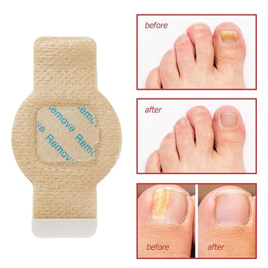 Nail Treatment Patches